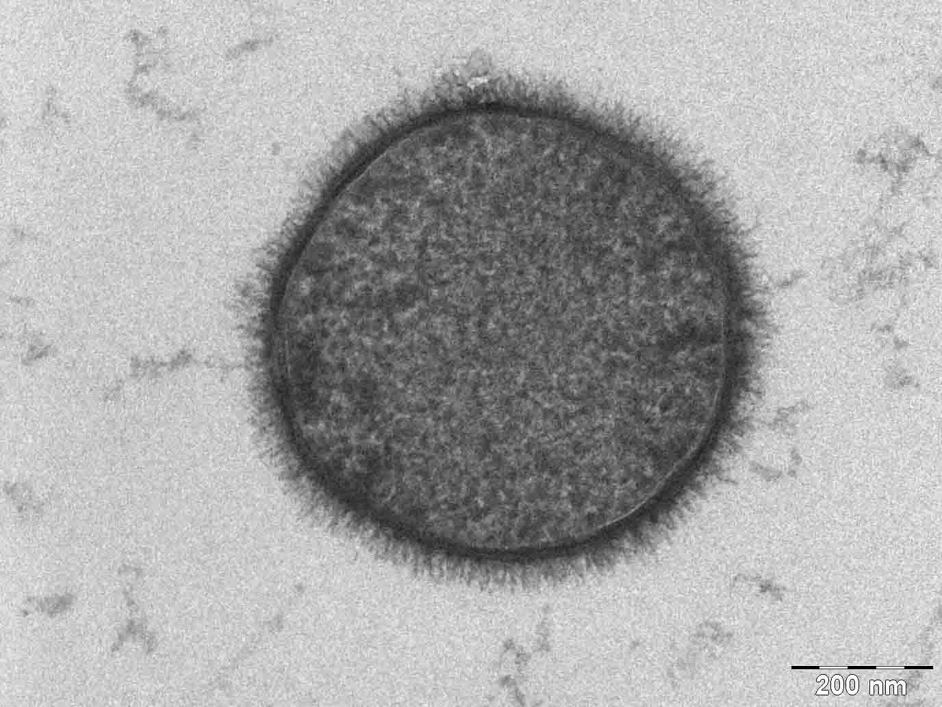 Penampang Bacillus subtilis pada mikrograf TEM Allon Weiner (2006), dengan bar skala sumber 200 nm.