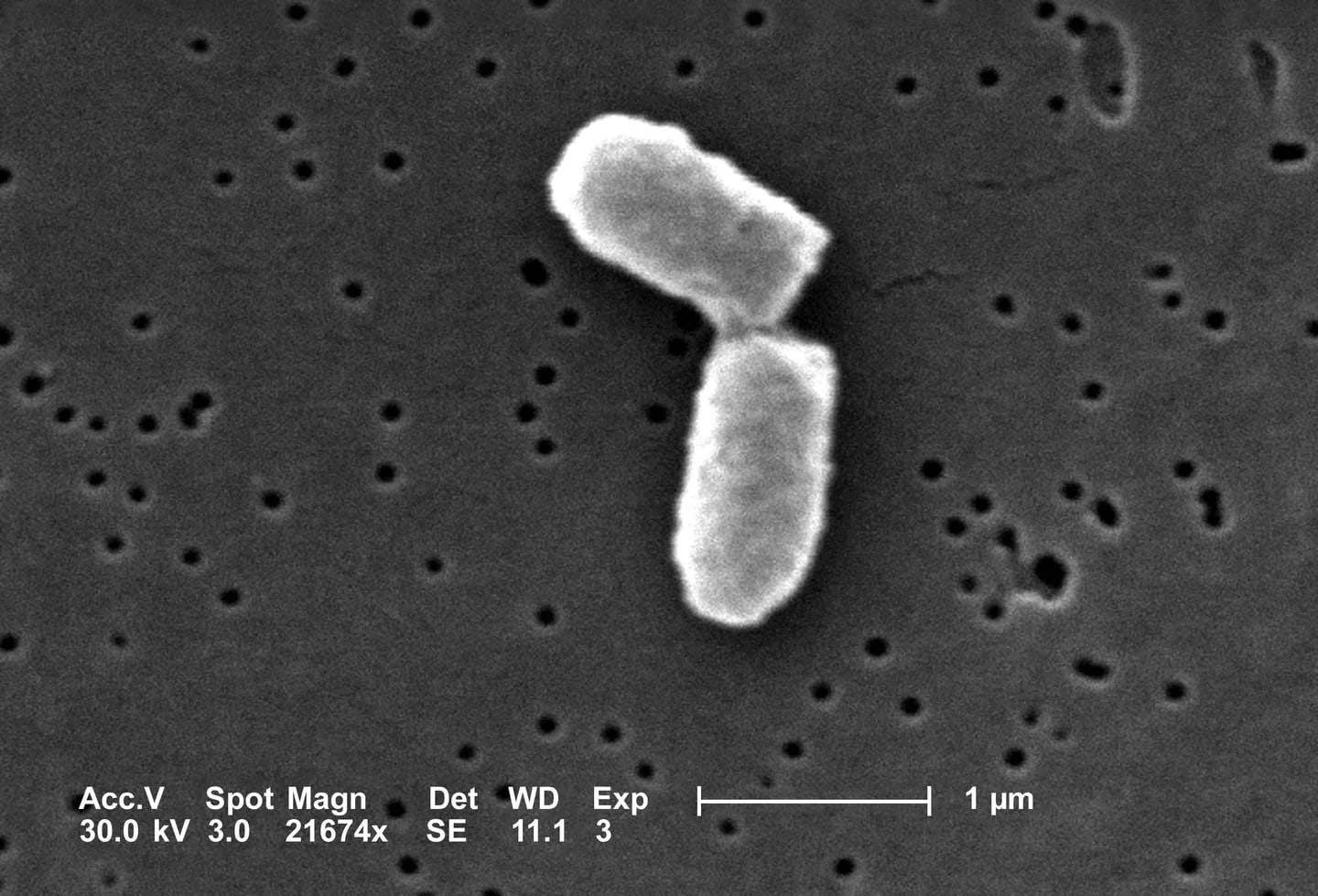 Dua bagian sel Escherichia coli pada proses pembelahan, diamati dengan SEM; bar skala sumber 1 µm.