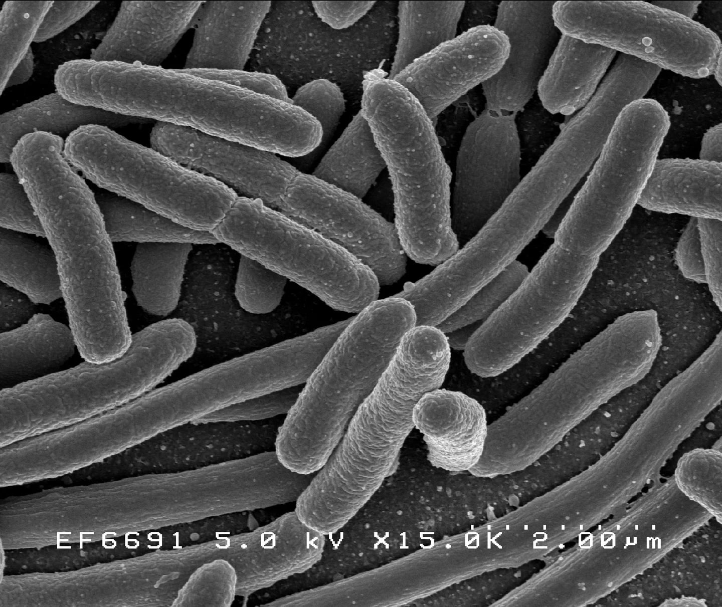 Escherichia coli dalam kultur, melekat pada cover slip. Mikrograf elektron pemindaian dari NIAID.