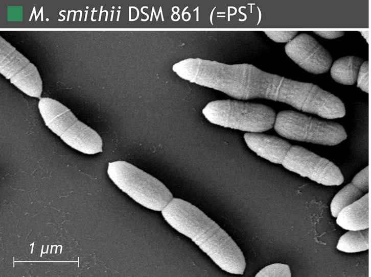 Methanobrevibacter smithii DSM 861 (= PSᵀ), mikrograf elektron pemindaian dari Weinberger dan kolega.