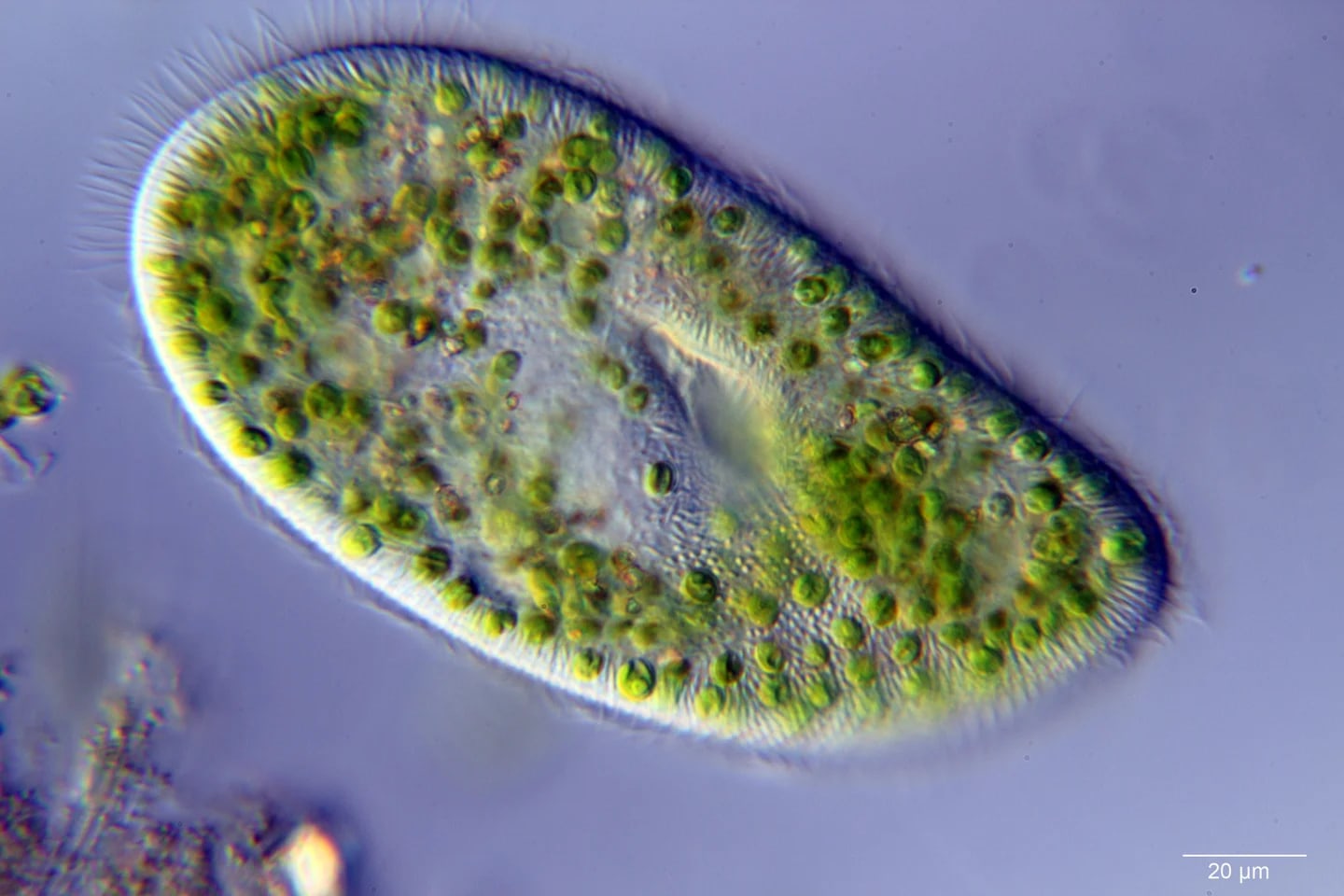 Paramecium bursaria dengan alga hijau di sitoplasma. Mikroskop cahaya dengan differential interference contrast (DIC).